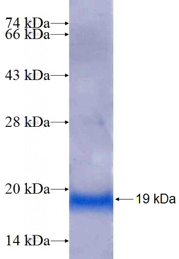Recombinant Human UBE2W SDS-PAGE