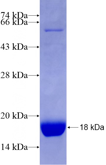 Recombinant Human FZD1 SDS-PAGE