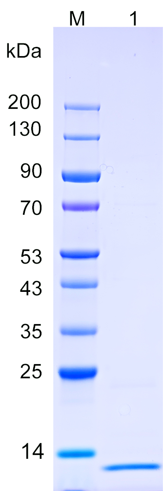 Recombinant ETV4 protein (His tag) SDS-PAGE