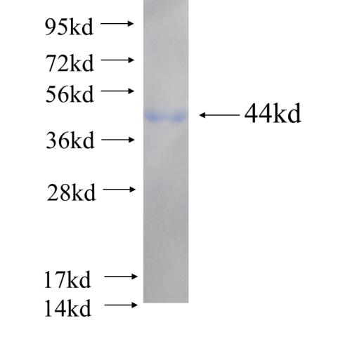 Recombinant human CLIP2 SDS-PAGE