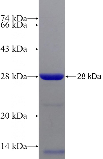 Recombinant Human SAMD9L SDS-PAGE
