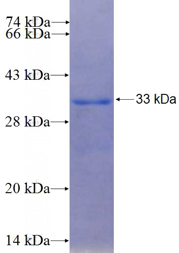 Recombinant Human KCTD3 SDS-PAGE