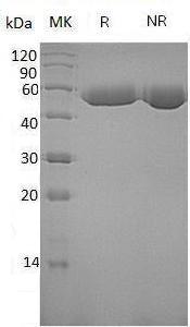 Human SERPINF1/PEDF/PIG35 (His tag) recombinant protein