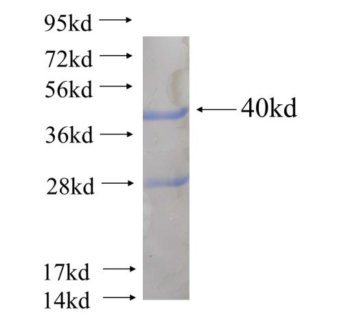 Recombinant human SLC32A1 SDS-PAGE