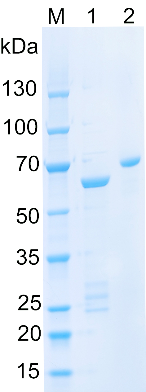 Recombinant human ANGPTL2 SDS-PAGE