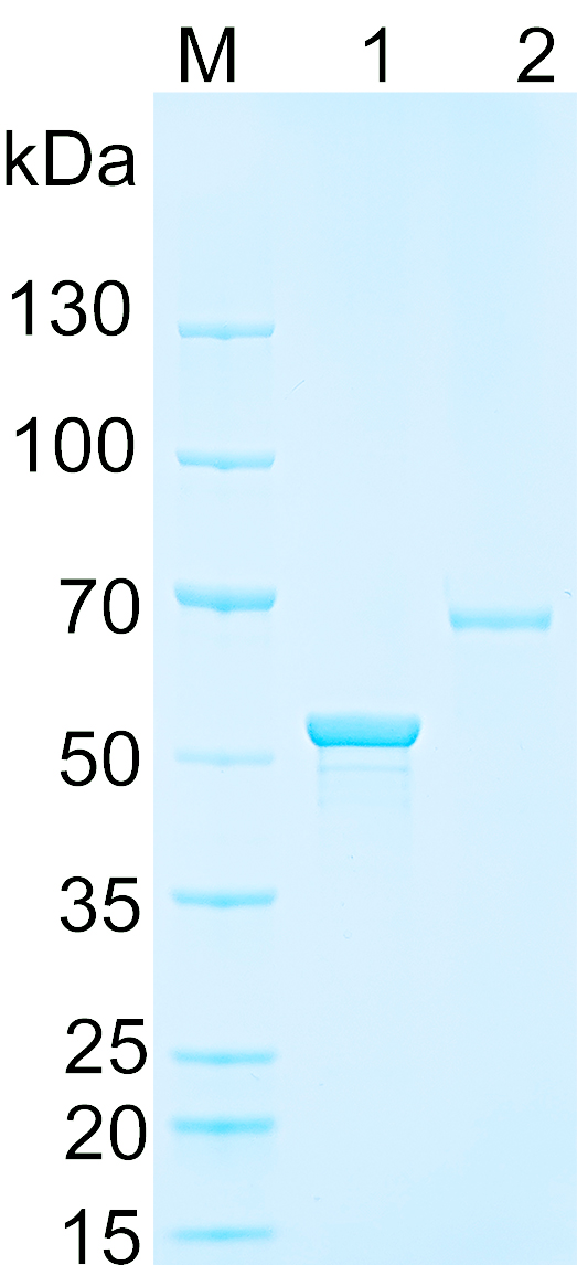 Recombinant Human MYO18A SDS-PAGE