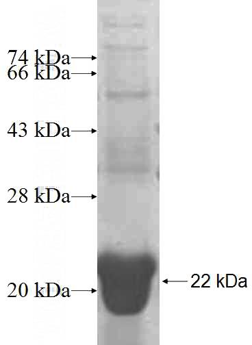 Recombinant Human GOLGA7 SDS-PAGE