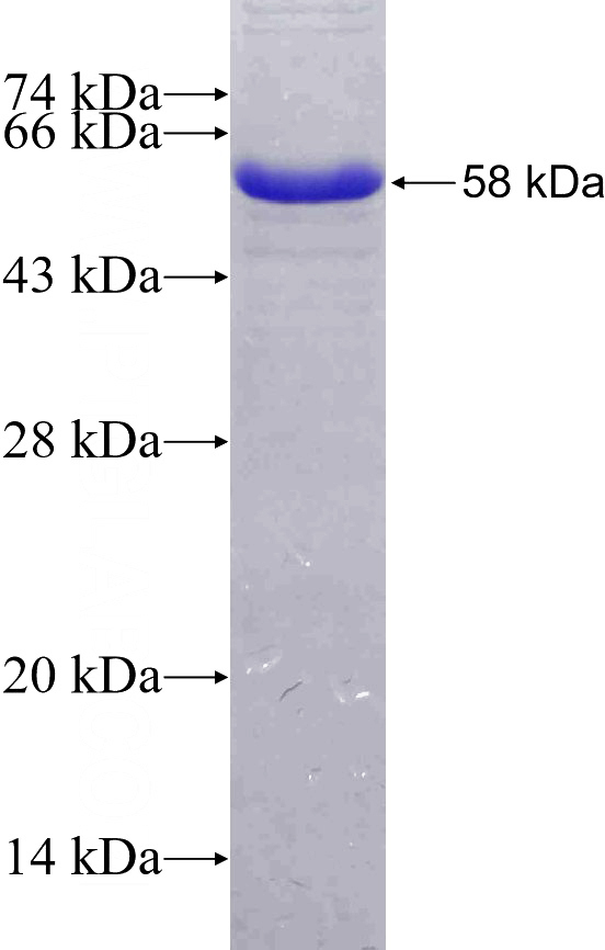 Recombinant Human EXOSC3 SDS-PAGE
