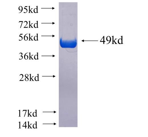 Recombinant human RP11-529I10.4 SDS-PAGE