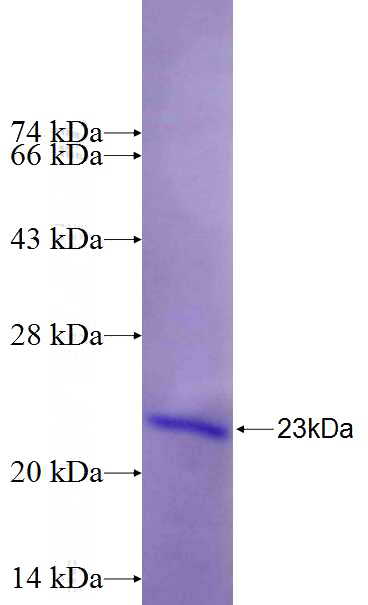Recombinant Human HEATR3 SDS-PAGE