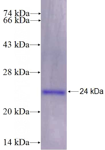 Recombinant Human MRPL23 SDS-PAGE
