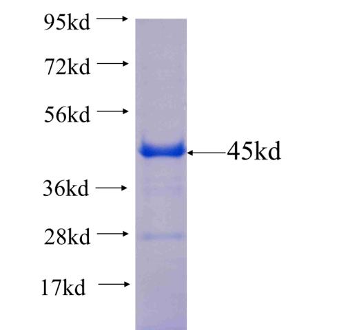 Recombinant human VPS26B(Full length) SDS-PAGE