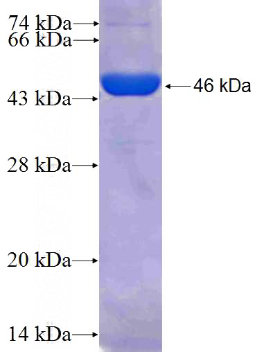 Recombinant Human SYMPK SDS-PAGE