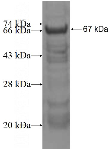Recombinant Human CNNM4 SDS-PAGE