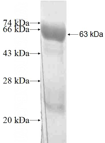 Recombinant Human RPIA SDS-PAGE