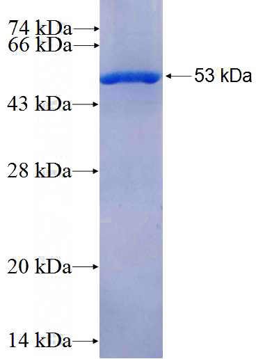 Recombinant Human HINFP SDS-PAGE