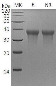 Mouse Trem1 (His tag) recombinant protein
