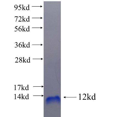 Recombinant human SLC39A13 SDS-PAGE