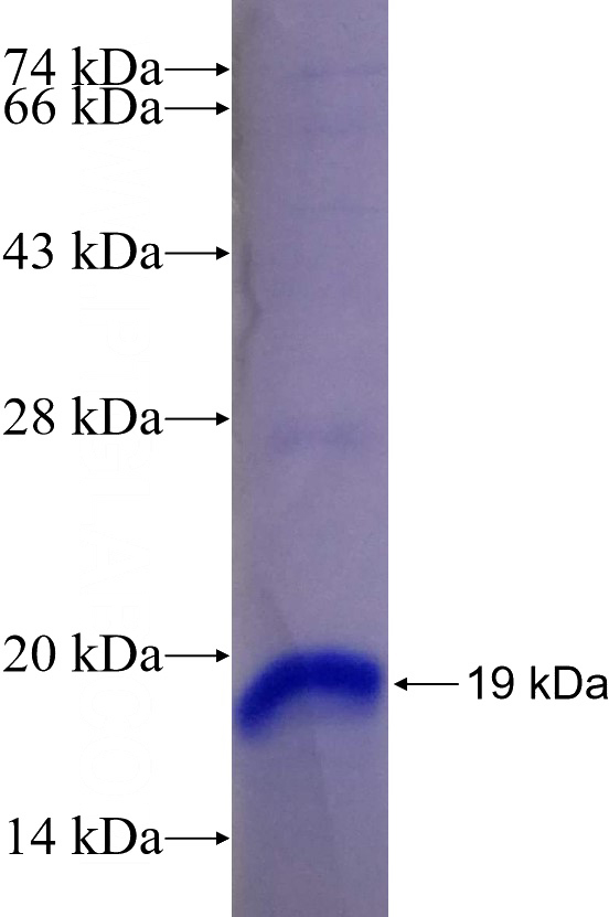 Recombinant Human ARHGEF7 SDS-PAGE