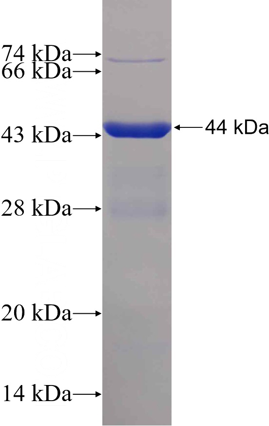 Recombinant Human GEMIN7 SDS-PAGE
