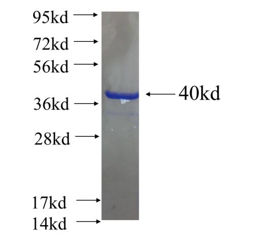 Recombinant human CFDP1 SDS-PAGE