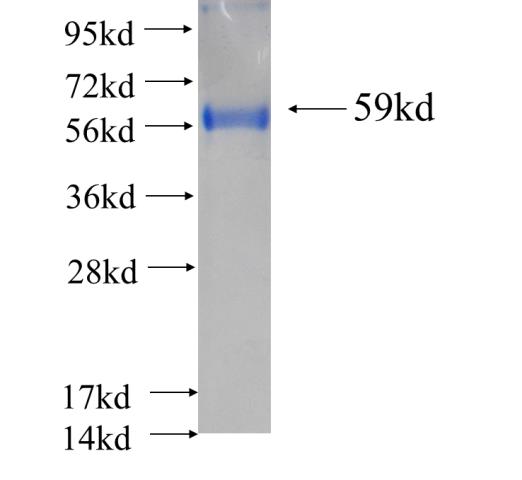 Recombinant human GLOD4 SDS-PAGE