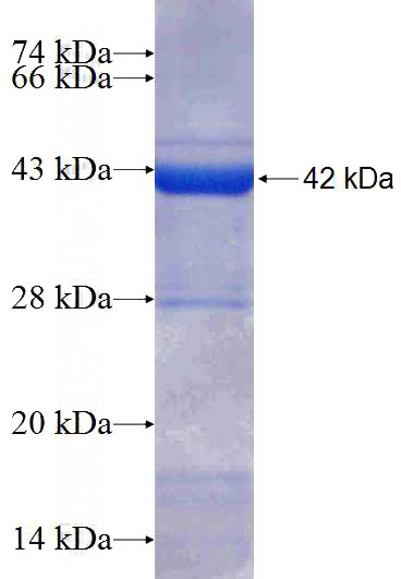 Recombinant Human INTS4 SDS-PAGE