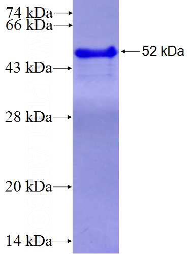 Recombinant Human VGF SDS-PAGE