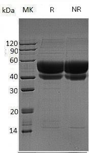 Human ST6GAL1/SIAT1 (His tag) recombinant protein
