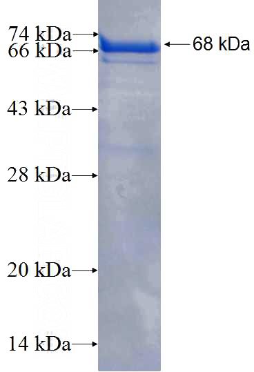 Recombinant Human CNTROB SDS-PAGE