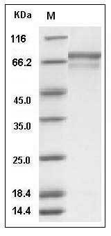 Human PRC1 Protein (His Tag) SDS-PAGE