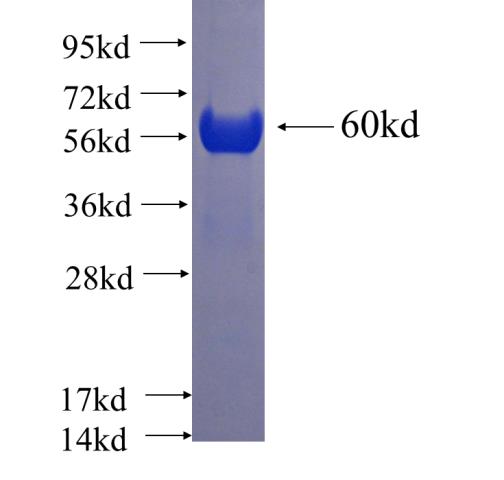 Recombinant human FASN SDS-PAGE