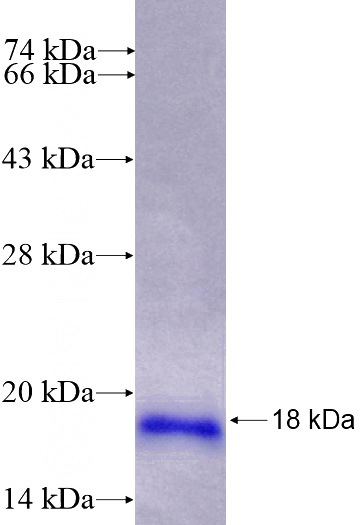 Recombinant Human POLR2I SDS-PAGE