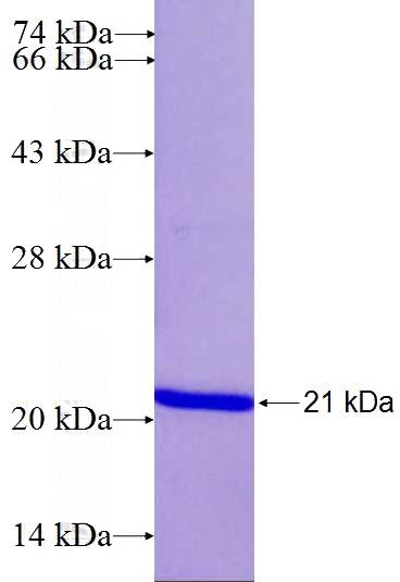 Recombinant Human PSMD8 SDS-PAGE