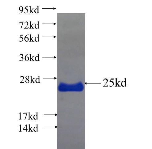 Recombinant human GATAD2B SDS-PAGE
