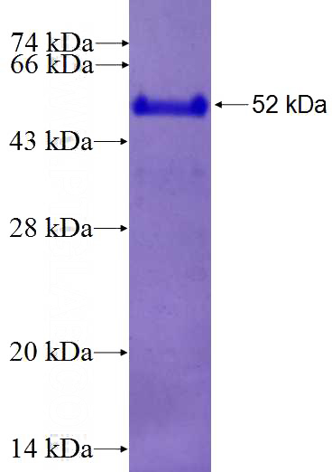 Recombinant Human APLP2 SDS-PAGE