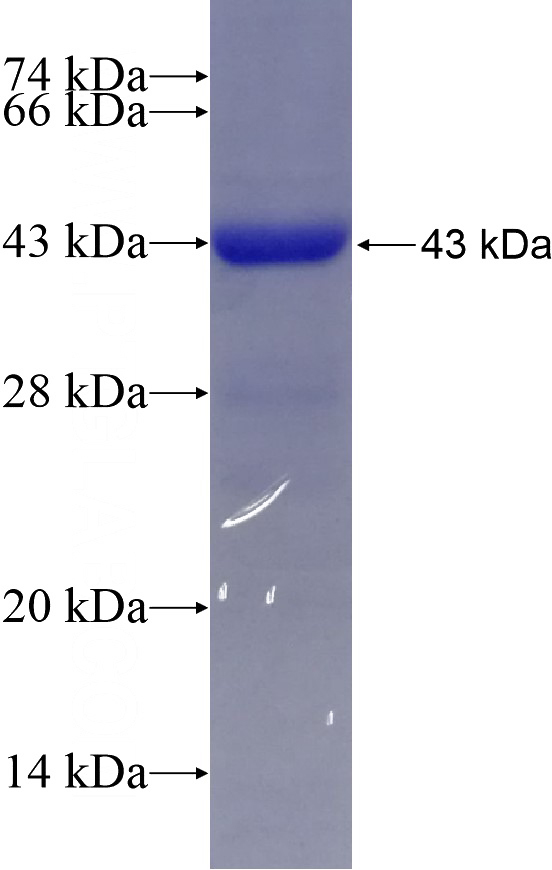 Recombinant Human CYP17A1 SDS-PAGE