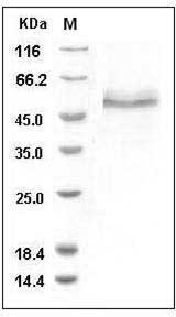 Human TRAIL R2 / CD262 / TNFRSF10B Protein (His & Fc Tag) SDS-PAGE