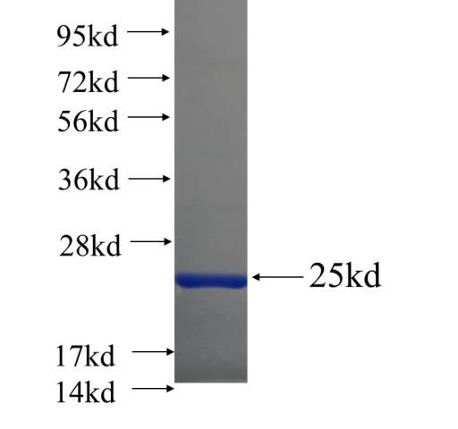 Recombinant human DEPDC7 SDS-PAGE
