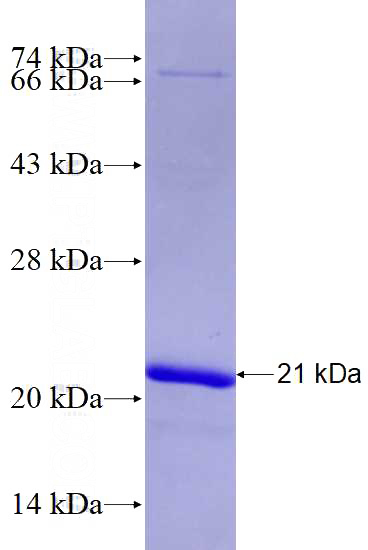 Recombinant Human PSEN1 SDS-PAGE