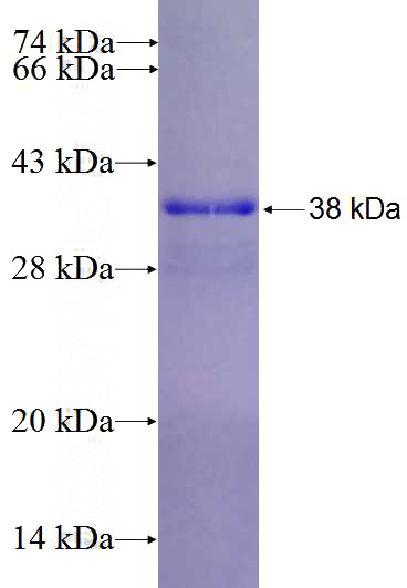 Recombinant Human PLCG2 SDS-PAGE