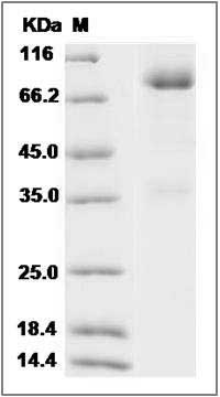 Rat GFRA1 / GFR alpha-1 Protein (Fc Tag) SDS-PAGE