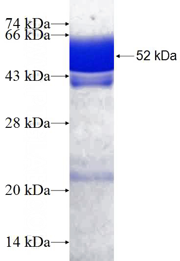 Recombinant Human RPAIN SDS-PAGE