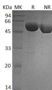Human IGSF8/CD81P3/EWI2/KCT4 (His tag) recombinant protein