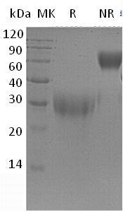 Mouse Pgf/Plgf (His tag) recombinant protein