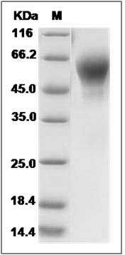 Mouse IL1R2 / CD121b Protein (His Tag) SDS-PAGE