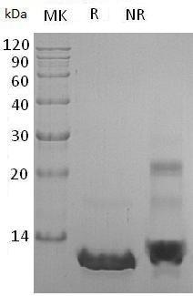 Human CCL8/MCP2/SCYA10/SCYA8 recombinant protein