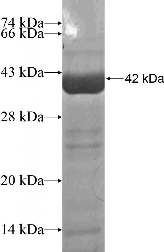 Recombinant Human MAOB SDS-PAGE