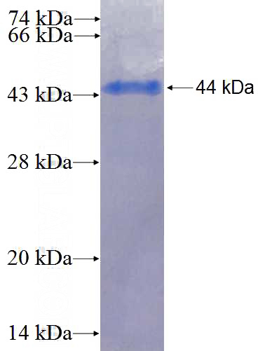 Recombinant Human ANGPTL1 SDS-PAGE