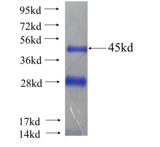 Recombinant human MYLPF SDS-PAGE